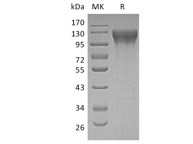 Recombinant Human ECE1 Protein (His Tag) - 1