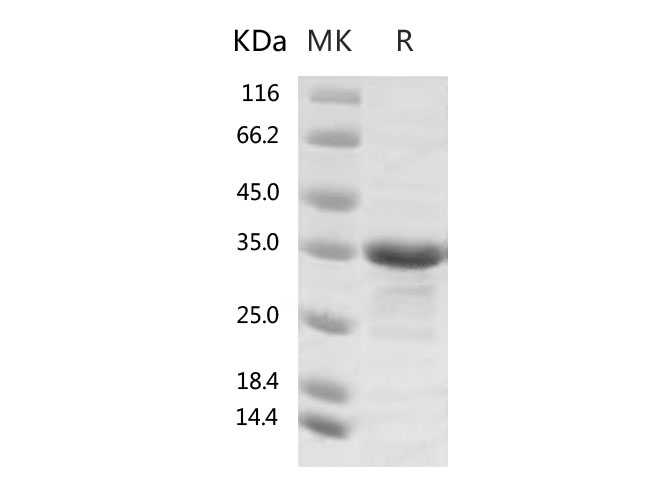 Recombinant SARS-CoV-2 Papain-like Protease Protein (His Tag) - 1