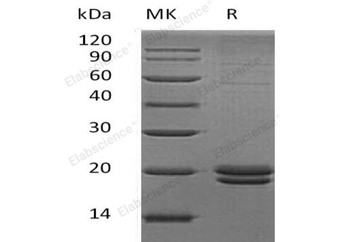 Recombinant Human VMO1 Protein (His Tag) - 1