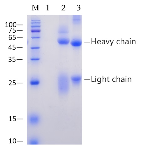 Protein A/G Magnetic Beads - 1