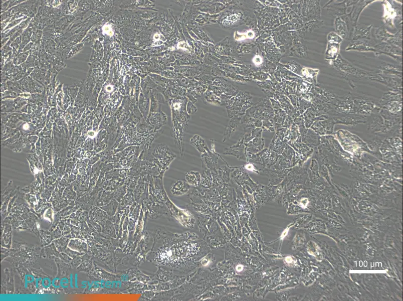 UM-Chor1 Cell Complete Medium - 3