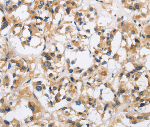 CKMT2 Polyclonal Antibody - 3