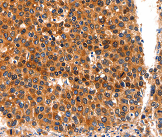 FGFR1 Polyclonal Antibody - 2