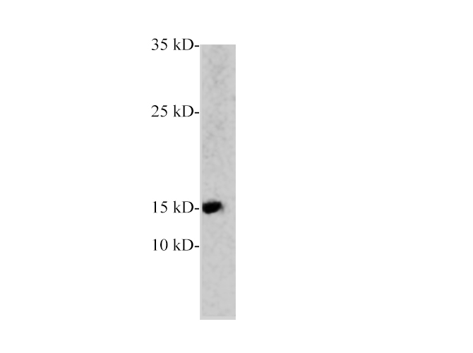 PCT Polyclonal Antibody - 1