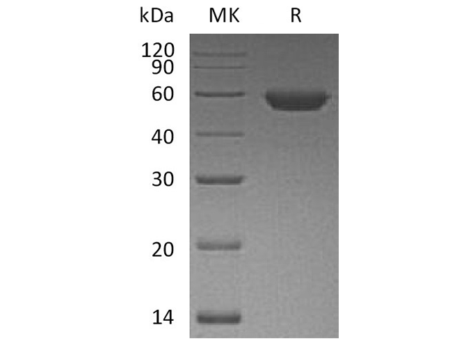 Recombinant Human ROR2 Protein (His Tag) - 1