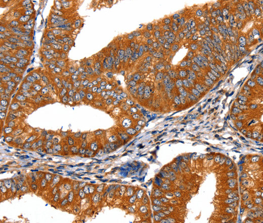 FGFR1 Polyclonal Antibody - 1