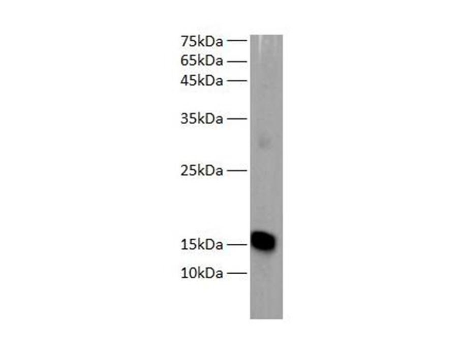 MB Polyclonal Antibody - 1