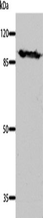 DNM1 Polyclonal Antibody - 1