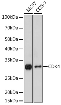 (KO Validated) CDK4 Polyclonal Antibody - 2
