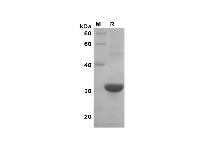 Recombinant GFP Protein - 1