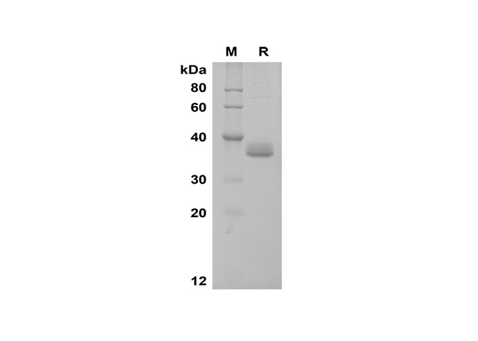 Recombinant Human ApolipoProtein E/ApoE Protein (His Tag) - 1