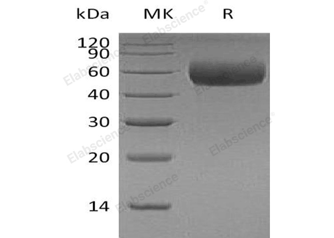 Recombinant Human Apolipoprotein H/ApoH Protein (His Tag) - 1
