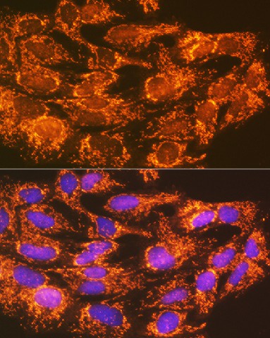 ACSL1 Polyclonal Antibody - 2