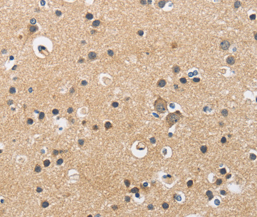 CKMT2 Polyclonal Antibody - 2