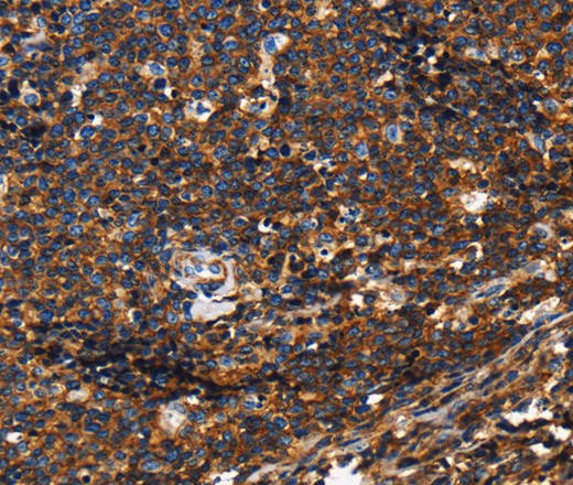 CD45 Polyclonal Antibody - 1