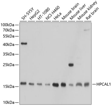 HPCAL1 Polyclonal Antibody - 1