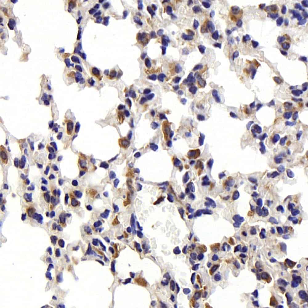 CD68 Polyclonal Antibody - small - 1