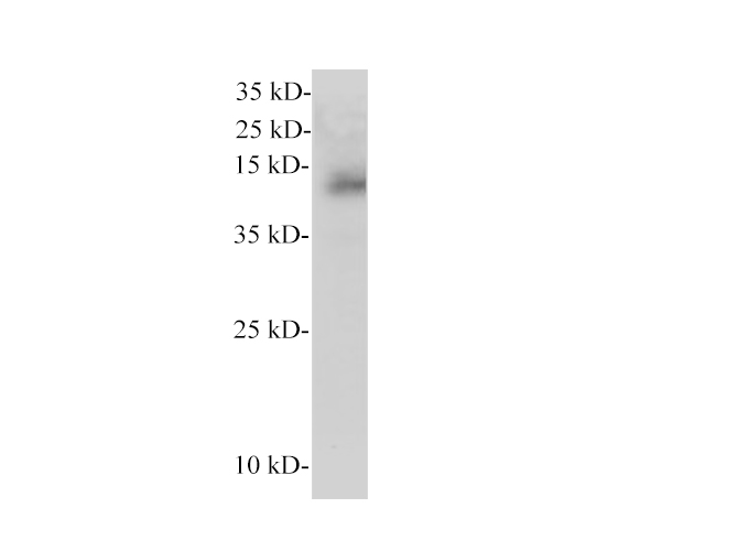 CEPT1 Polyclonal Antibody - 1