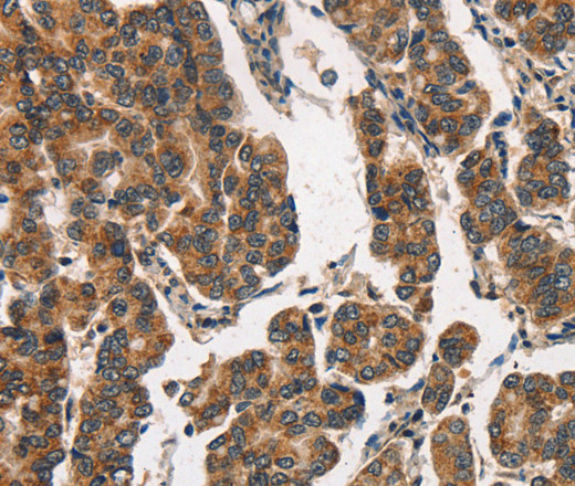 ITGA2 Polyclonal Antibody - 3