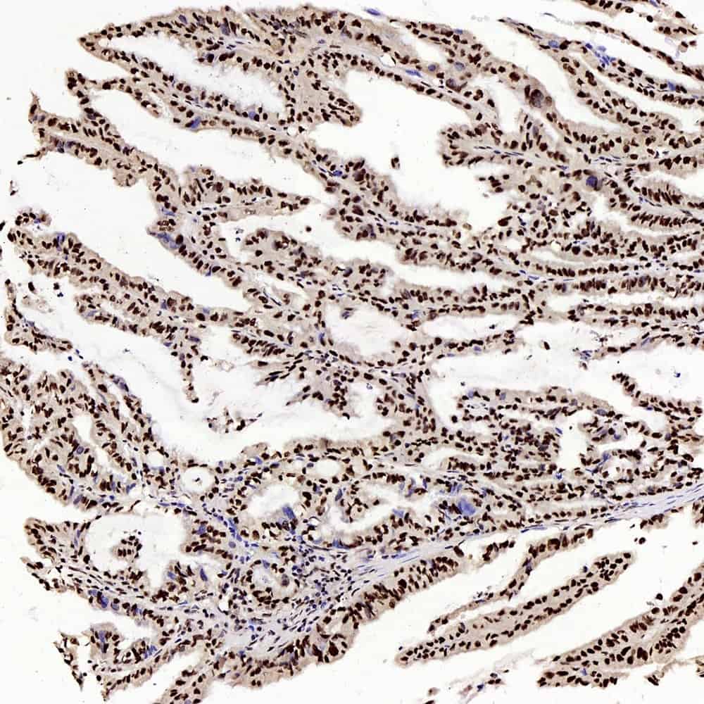 c-Fos Polyclonal Antibody - 2