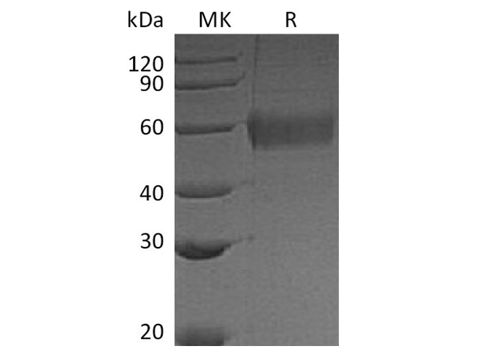 Recombinant Vaccinia virus Soluble Interferon α/β Receptor B18 Protein (His Tag) - 1