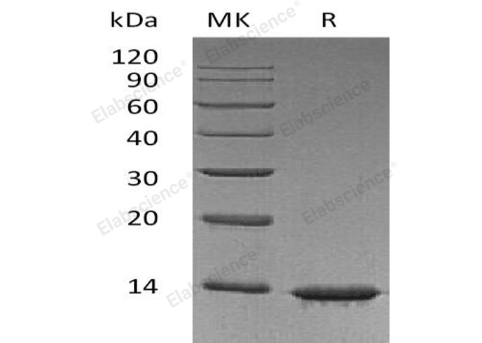 Recombinant Human Leptin Protein - 1