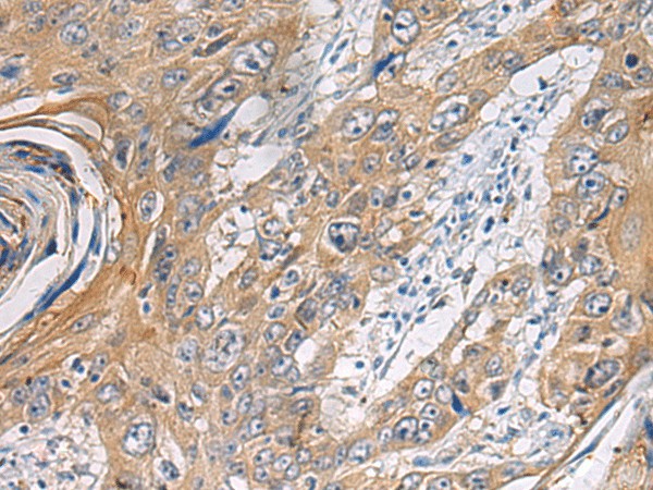 PA2G4 Polyclonal Antibody - 1