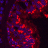 CD68 Monoclonal Antibody - 3