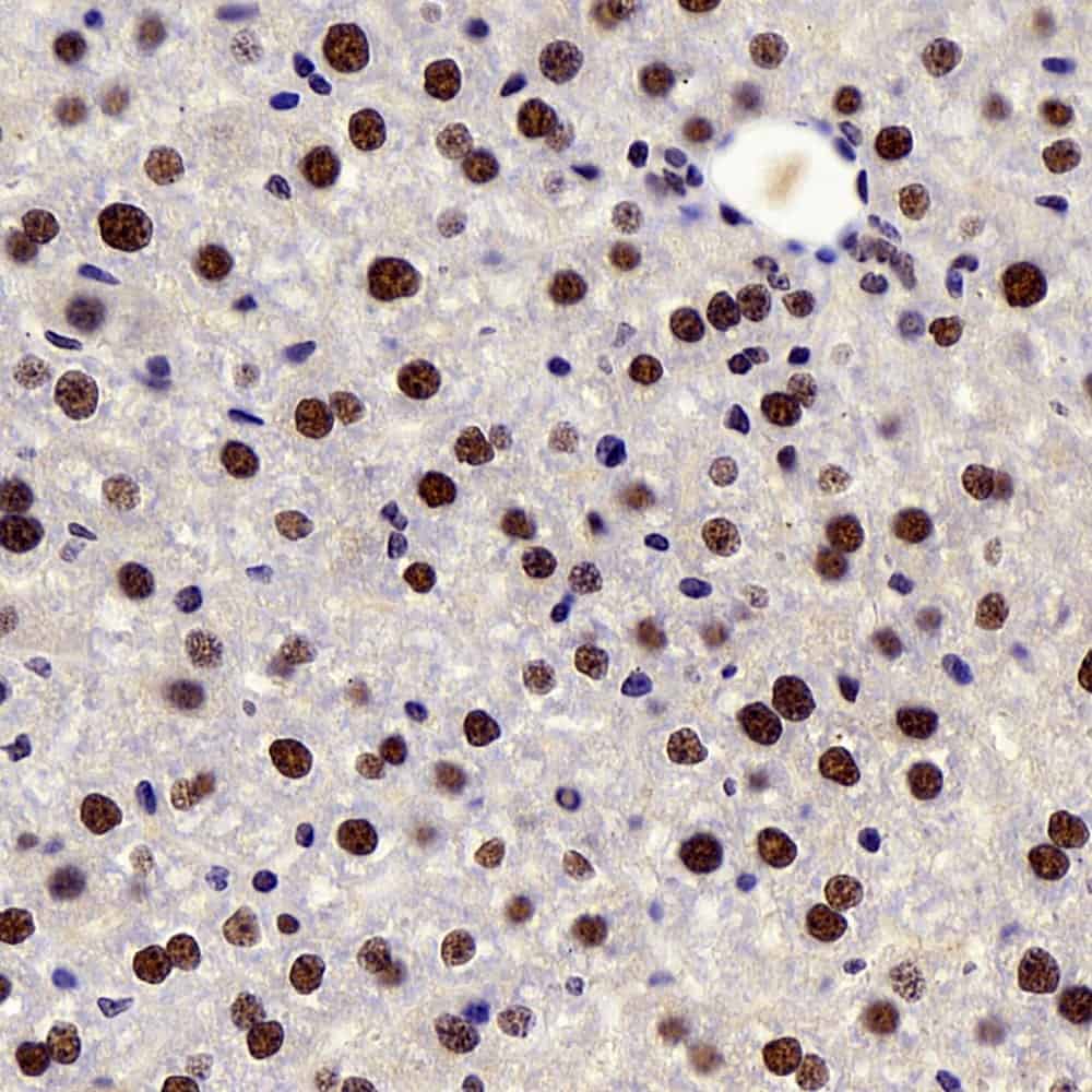 c-Fos Polyclonal Antibody - 3