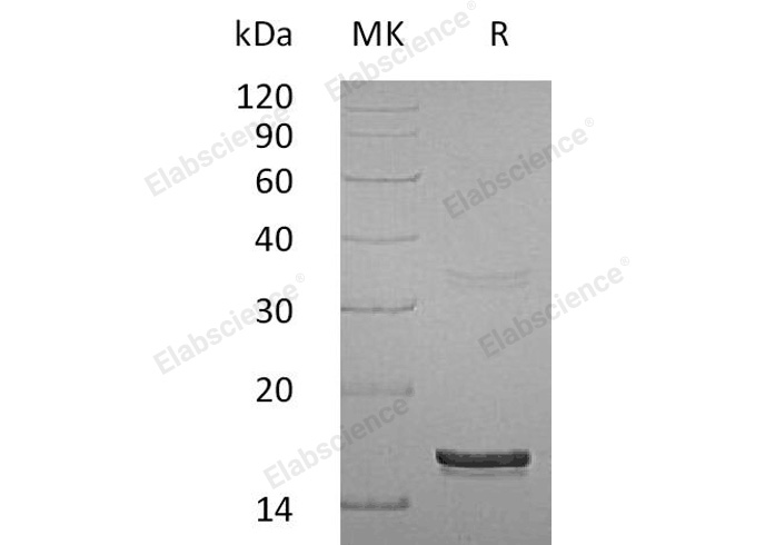 Recombinant Human Interferon γ/IFNG Protein - 1