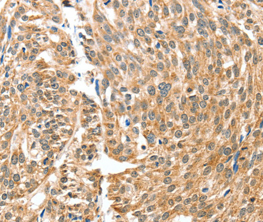 BAX Polyclonal Antibody - 2