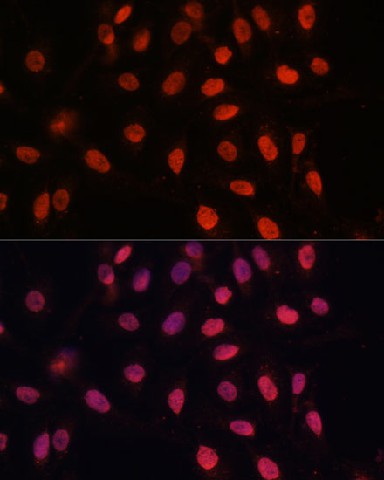 Bcl-2 Polyclonal Antibody - 3