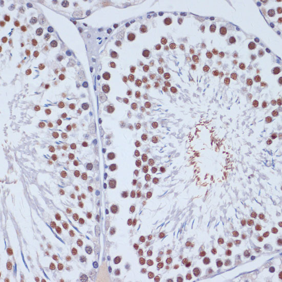 DNMT3L Polyclonal Antibody - 1