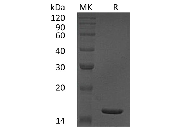 Recombinant Human TNF-alpha/TNFA Protein - 1