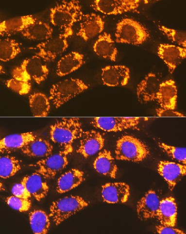 ACSL1 Polyclonal Antibody - 3