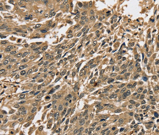 PPP1CC Polyclonal Antibody - 2