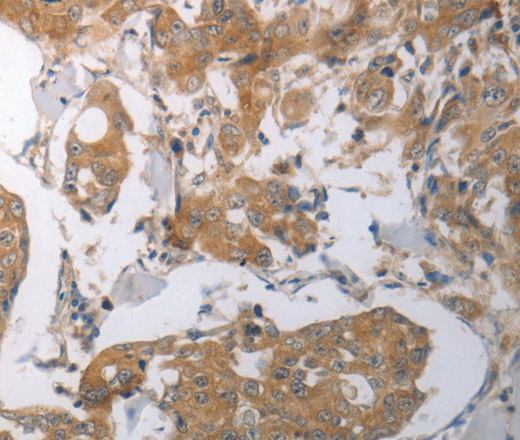 SHH Polyclonal Antibody - 1