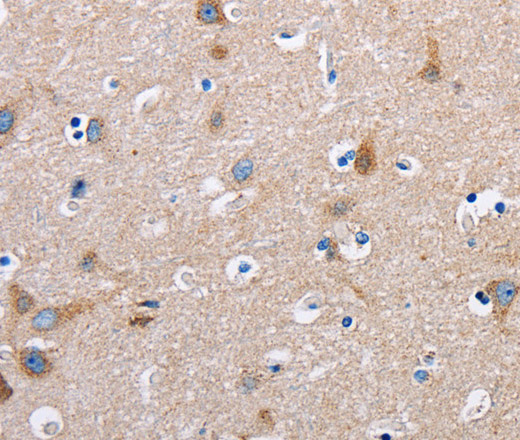 FN1 Polyclonal Antibody - 1