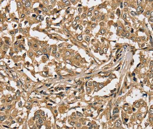 PPP1CC Polyclonal Antibody - 3