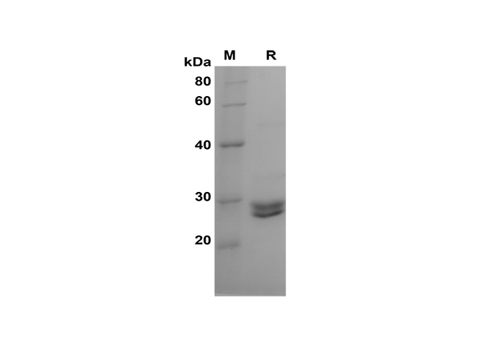 Recombinant Mouse DNMT1 Protein (His Tag) - 1