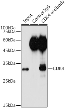 (KO Validated) CDK4 Polyclonal Antibody - small - 6