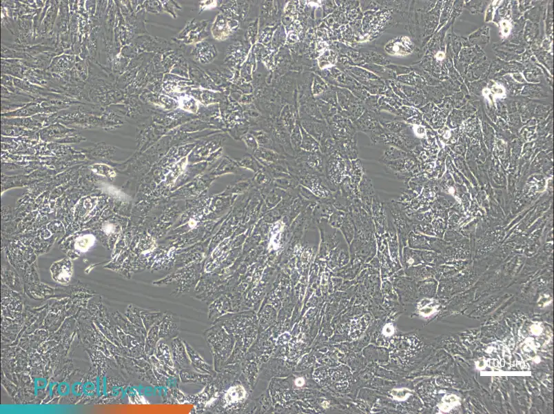 UM-Chor1 Cell Complete Medium - 1