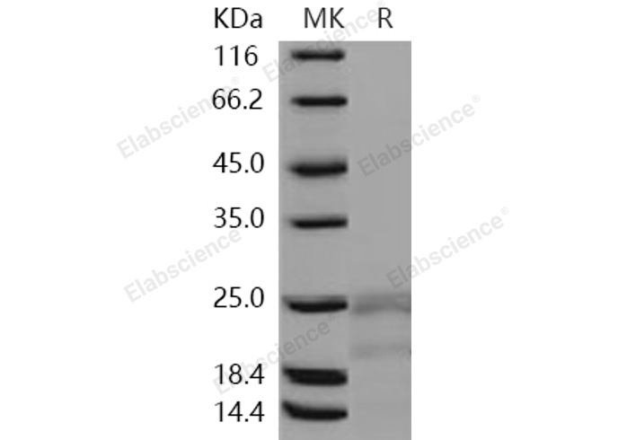 Recombinant Human Interferon γ/IFNG Protein - 1