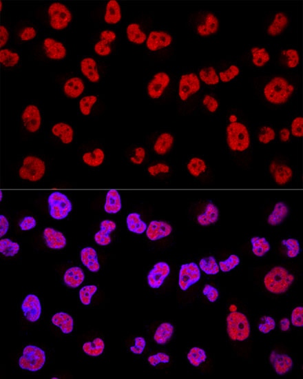 METTL3 Polyclonal Antibody - small - 4