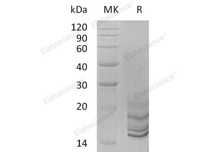 Recombinant Human Progonadoliberin-2/GNRH2 Protein (His Tag) - 1