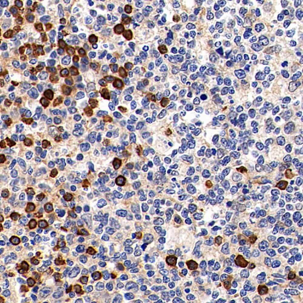 Cyclin B1 Polyclonal Antibody - 2