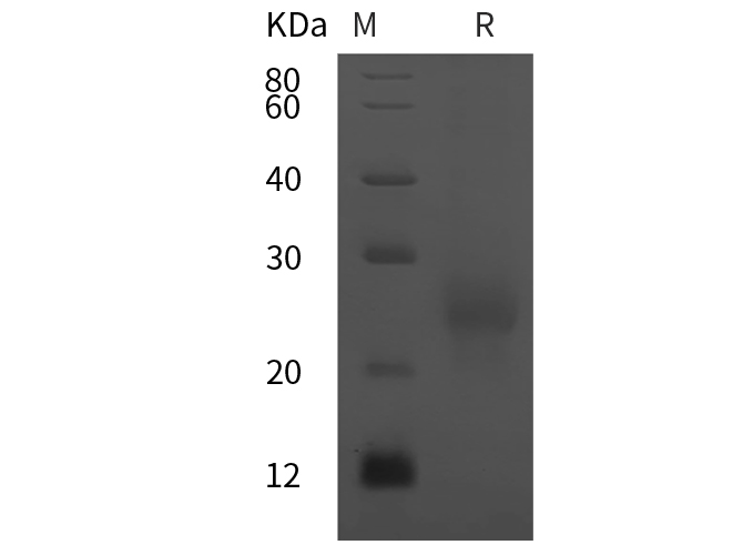 Recombinant HumanFSHa/CGA Protein (His Tag) - 1