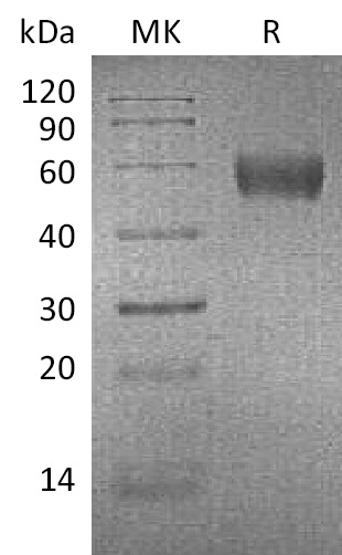 Recombinant Mouse Apolipoprotein H/ApoH Protein (His Tag) - 1