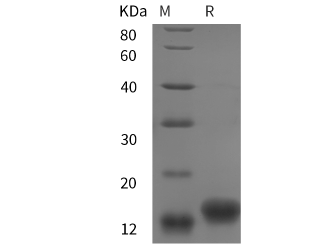 Recombinant chiken IGF1/IGF‑I/IGF-1 Protein (His Tag) - 1