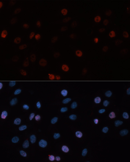 DNMT3B Polyclonal Antibody - 3